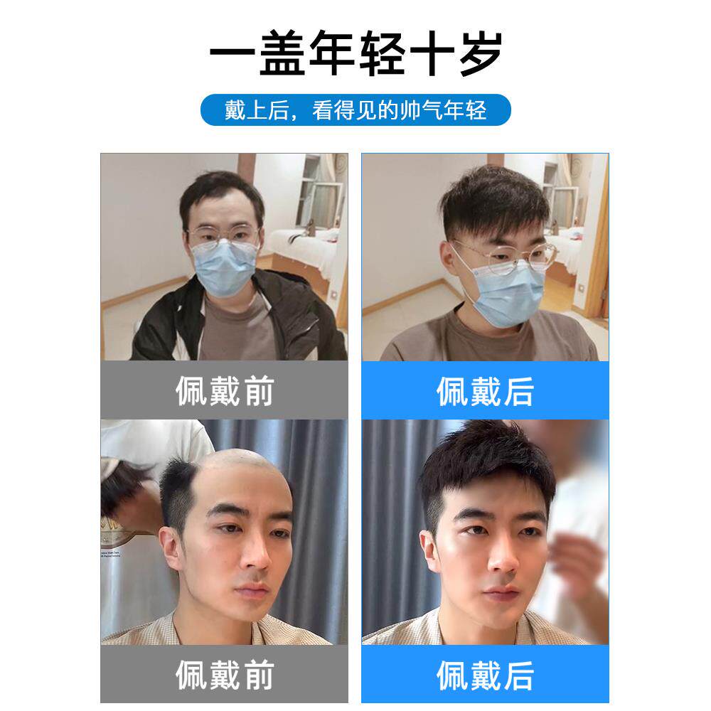 假发男短发真发毛寸假发片可粘可卡隐形无痕中老年男士头顶补发块