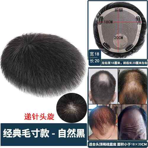 高档假发男短发真发气毛寸补发男士秃帅顶片头顶补发轻薄然透气清