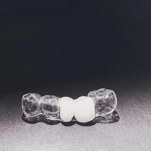 门牙假牙套牙仿真牙齿贴面全瓷牙贴片遮盖缺牙神器临时遮丑牙套