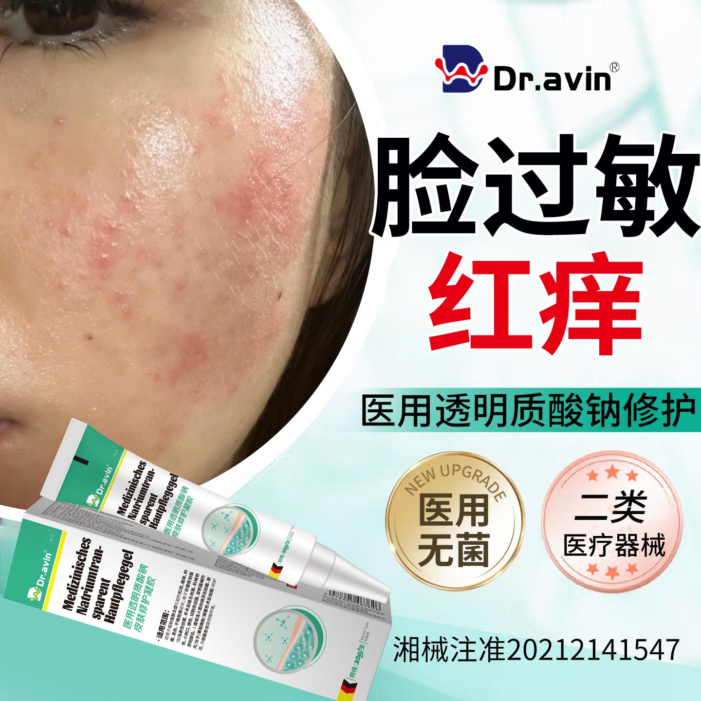 脸上干燥皮过敏皮肤修复脸部红痒起修复医用型急救凝胶屏障受损RW