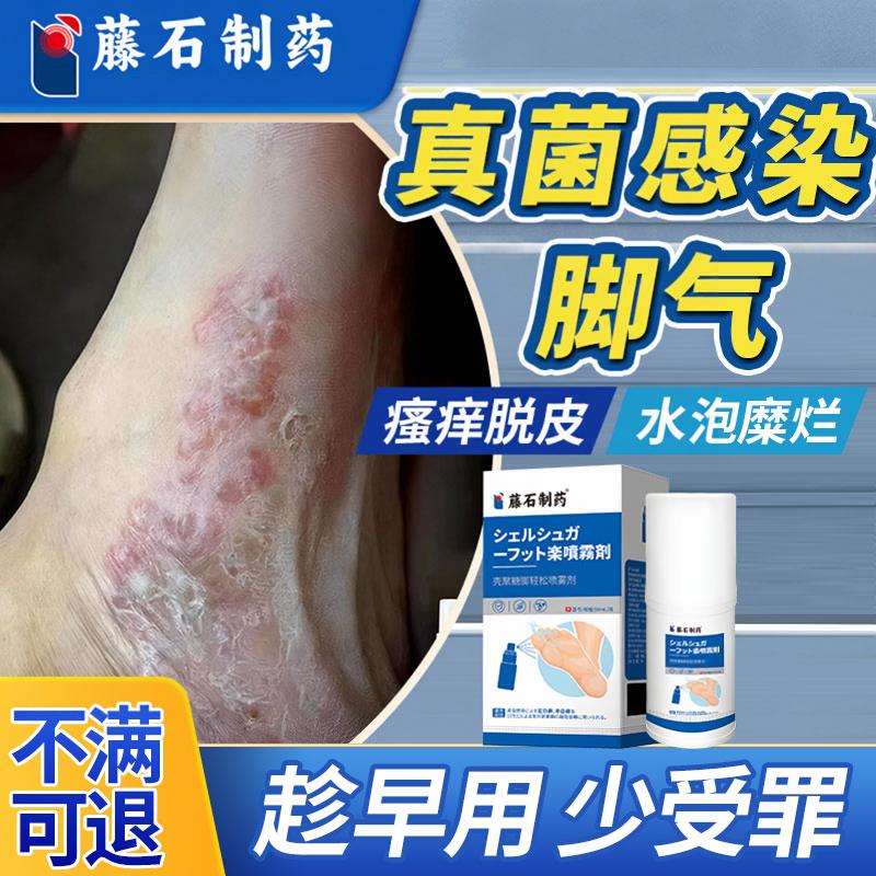 足癣脚癣一次净脚痒脚藓药同售膏真菌房感染干裂脱皮脚气喷雾SK医