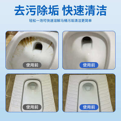 【尿碱黄垢克星】马桶泡腾片强力去污垢尿碱泡腾片活氧除垢杀菌
