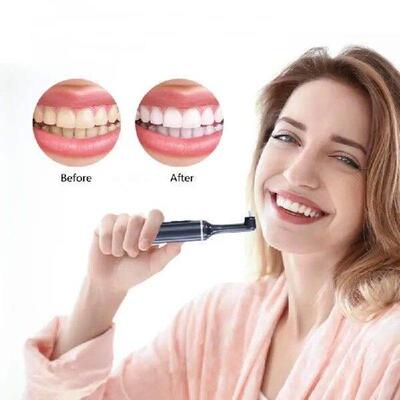 Electric Tooth Polisher Set Electric Teeth Lightening Set