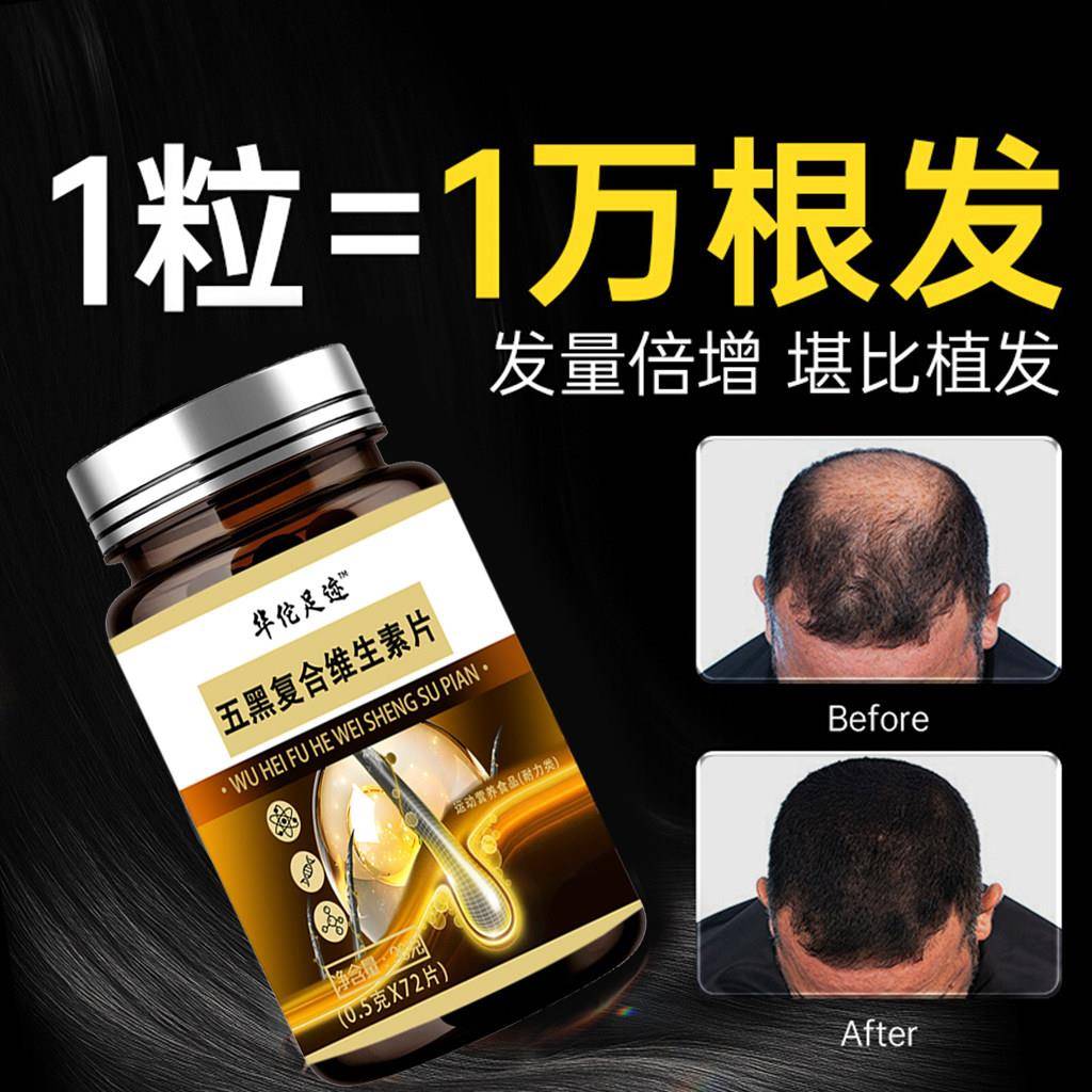 维生素b6族防脱发生发复合片掉头发严重吃什么hb7养发内调生物素