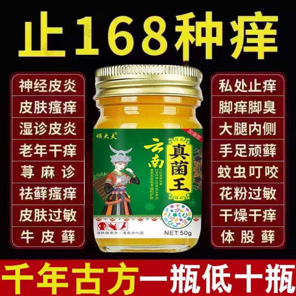 云南真菌王脚脚痒水泡脱皮气脚臭香港脚脚汗烂脚丫真菌感染止痒膏