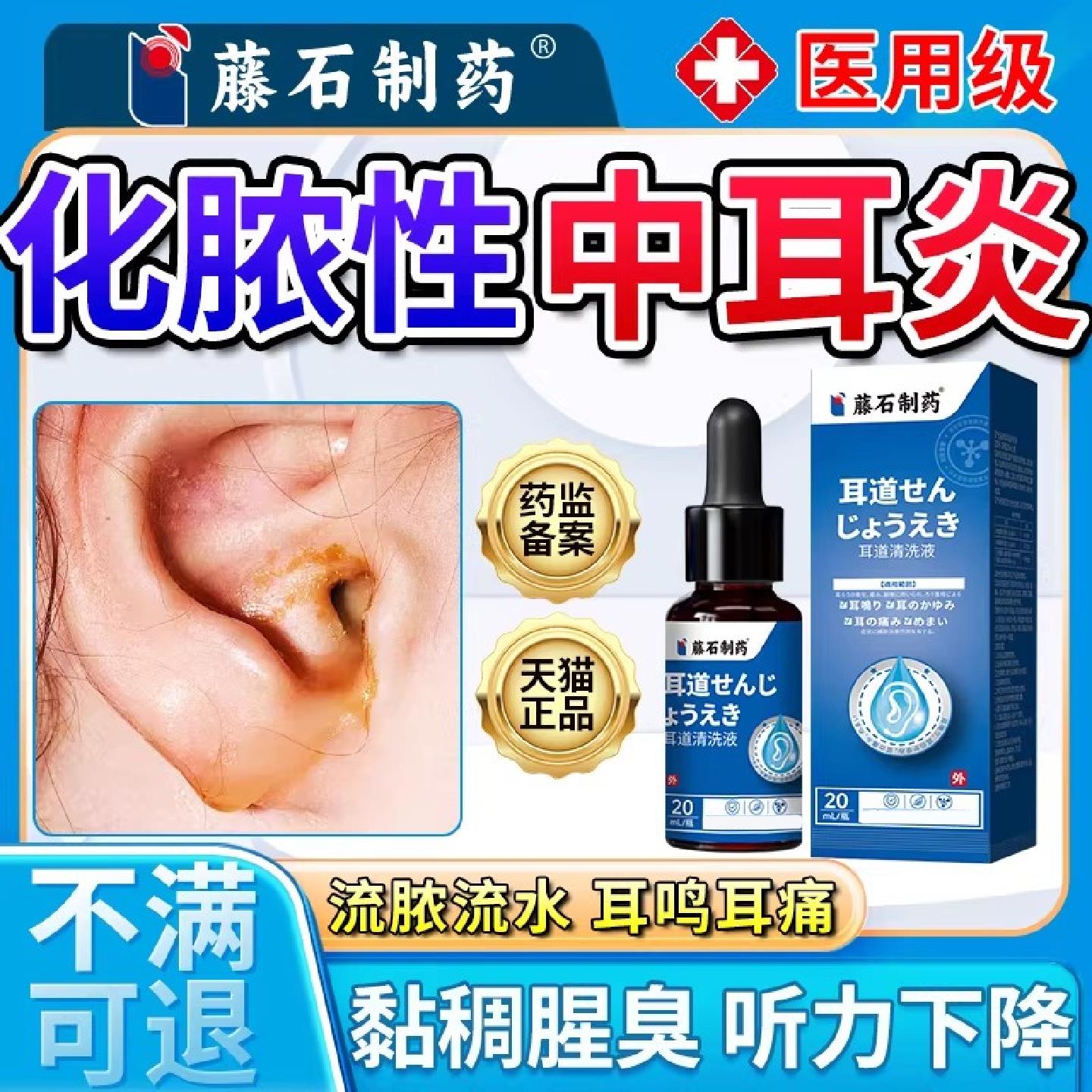慢性化脓性中耳炎专用耳朵流黄水滴耳液耳内鼓膜刺脓痛耳鸣腥臭SK
