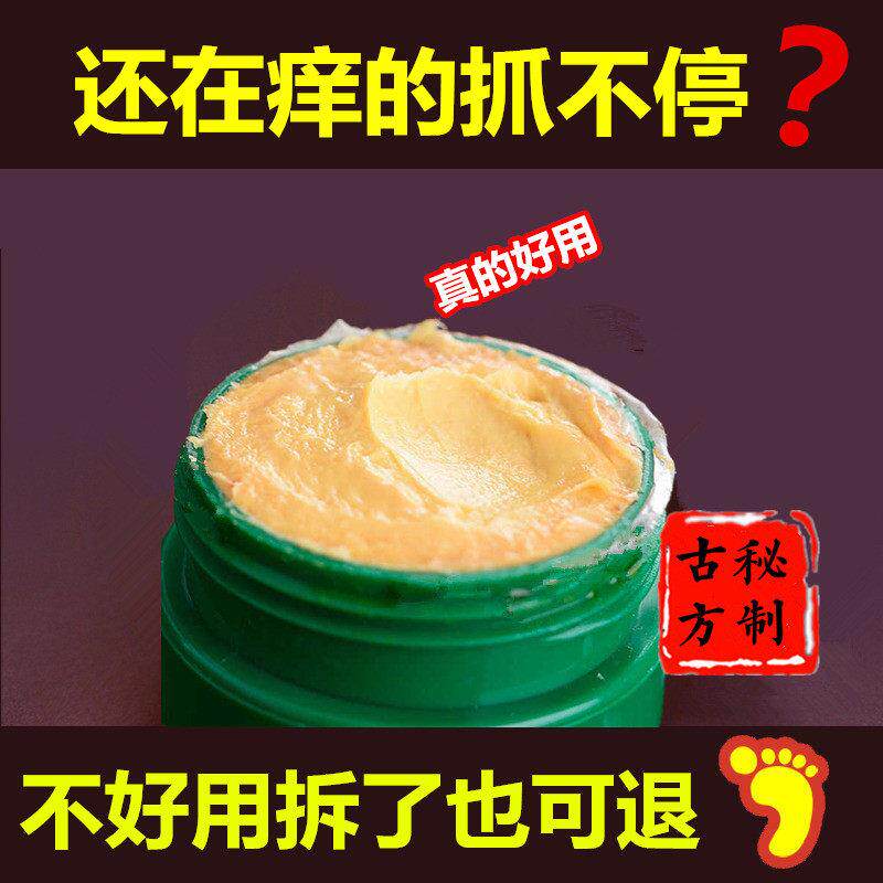 手痒脱皮干 干裂小腿脖子皮肤痒的抓出血水泥过敏草本小乳膏止痒