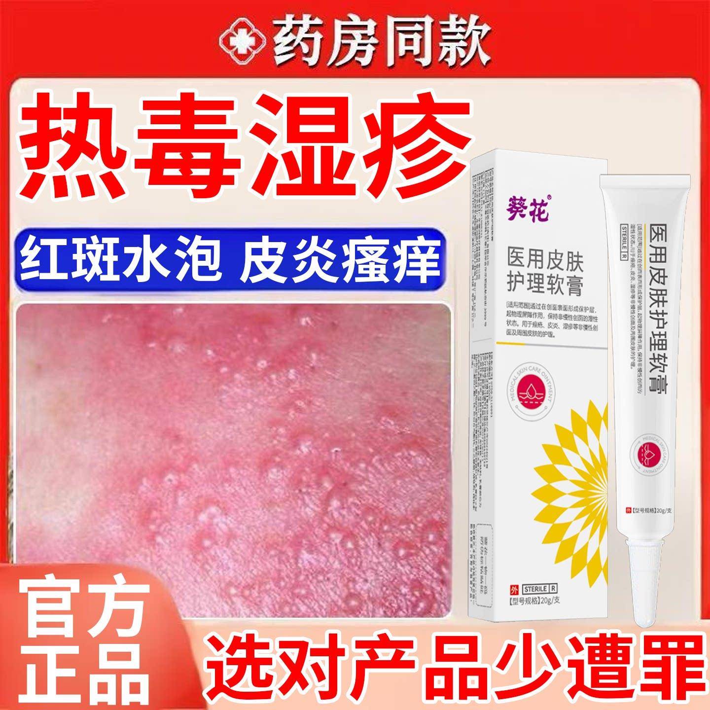 热毒湿疹止痒专用膏膏除湿皮肤一热就痒湿毒清软祛根湿痒皮炎水泡