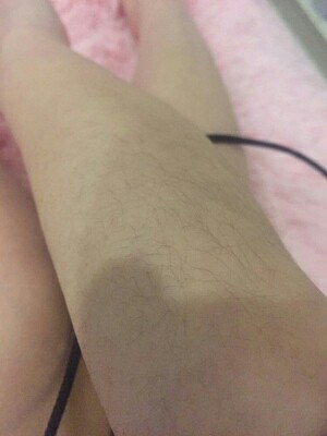 艾纳优冰点激光脱毛仪器家用脱毛器怎么样？我必须如此告诉大家实情