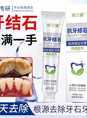 琛兰徽抗牙结石专用牙膏祛去除牙石溶解剂速效型清理牙垢XQ