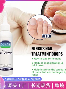OUHOE Gray Nail Repair Drops - Nail Care Solution for Restor