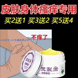 玉裂康乳膏牛皮癣汗包膏手痒手足癣脱皮手流脓皮肤瘙痒过敏湿疹膏