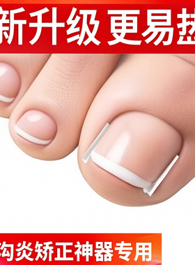 矫正器指甲专用趾甲纠正美甲工具