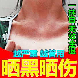 晒黑了皮肤晒伤晒后军训修复霜怎么快速变白霜，儿童男士美白乳面部