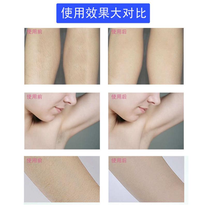 女士专用全身新款USB脱拔连根拔起毛器电动脱毛器除毛器腋毛腿毛