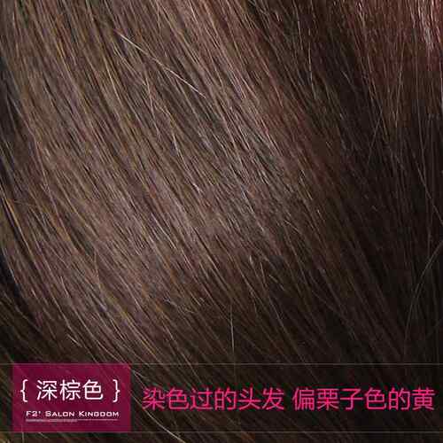 正品优质版 全真发高颅顶垫发发片 贴发头顶蓬根松神器补假发隐形