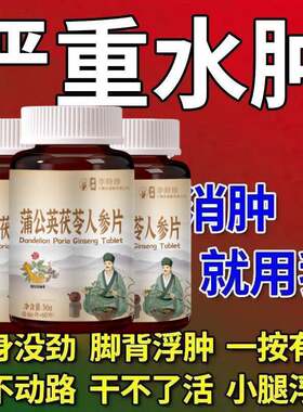 消水肿去脚肿消肿的药活血散淤蒲公英茯苓老人下肢腿水肿浮肿胀痛