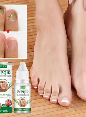 EELHOE Fungal Nail Care Liquid - For Thickened, Discolored,