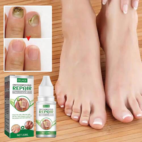 EELHOE Fungal Nail Care Liquid - For Thickened, Discolored,