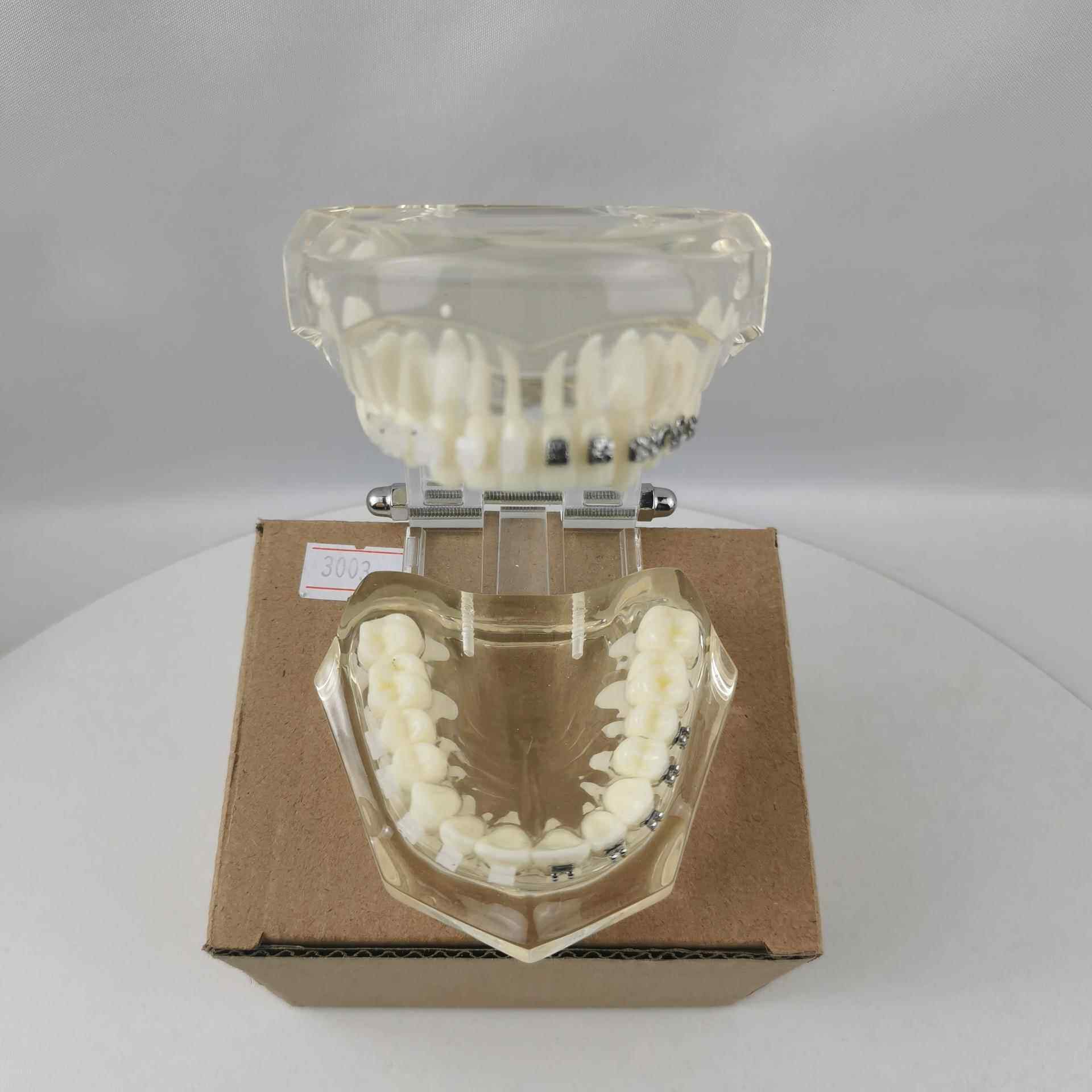 M3003半金属半陶瓷托槽演示牙齿模型