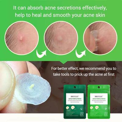 Acne Pimple Patch Stickers Treatment Pimple Remover 痘痘贴