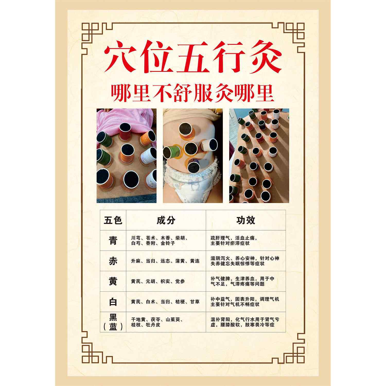 穴位五行灸海报中医艾灸养生装饰画贴纸艾灸的好处功效海报贴画