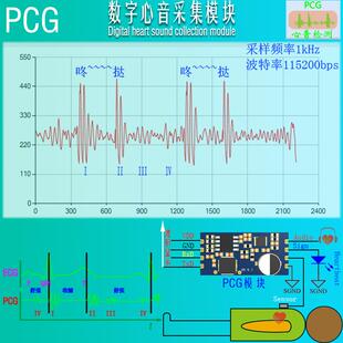 心音采集检测模块传感器心率电子听诊PCG Heart sound collection
