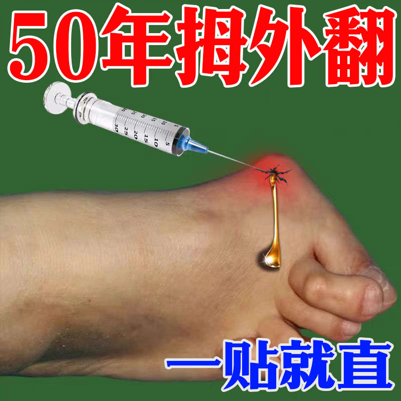 拇指外翻矫正器大脚骨拇囊炎大脚趾关节疼痛严重变畸形药膏贴神器