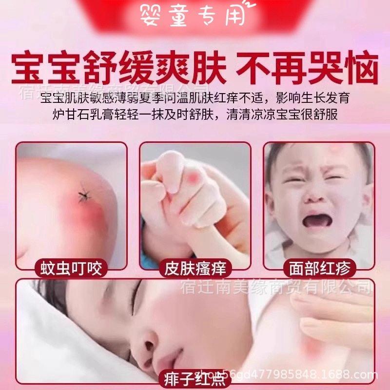 丝凯炉甘石宝宝倍缓护修膏0-RGL用12岁丽婴幼儿外去痱子无刺激消