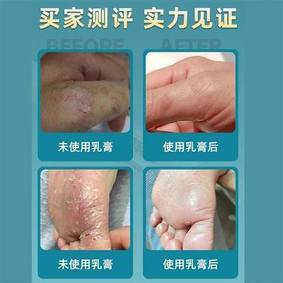 足曦乳抑菌膏官方正品线下同售LTK郑修远理堂抑菌乳膏郑元保湿护