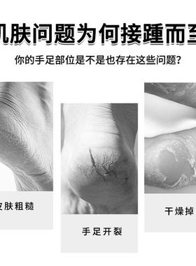 金志龙花干裂王软膏干裂掉红皮手脚干裂RPU滋润皮脱皮肤外用抑菌