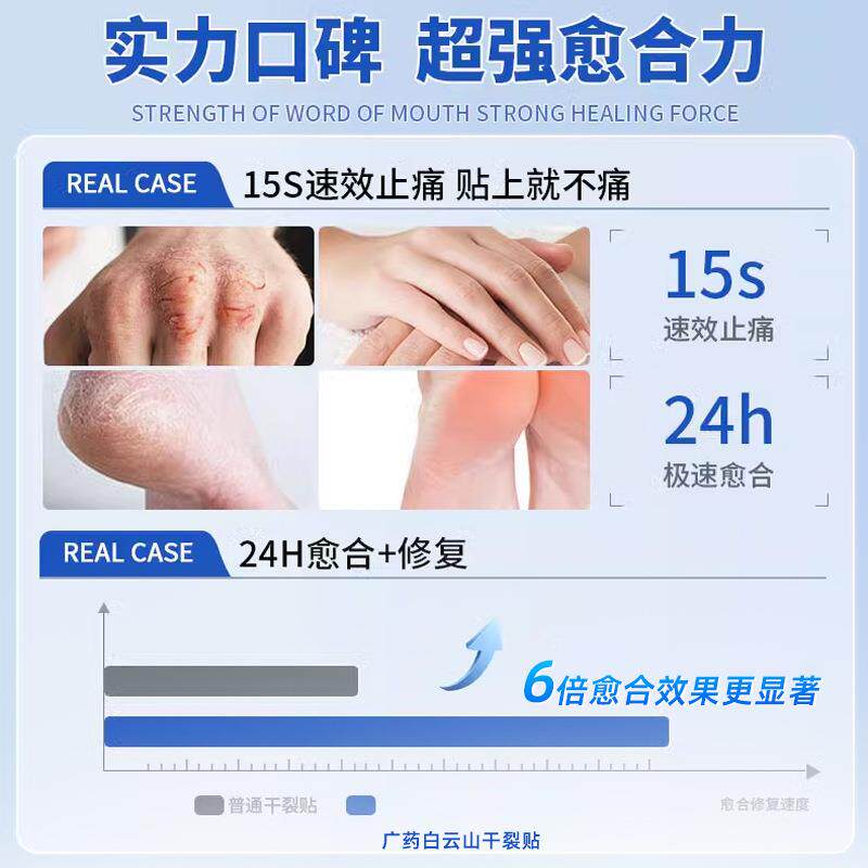 次日达云山手白脚贴干裂贴手足保手指脚后跟干皲裂口护胶带防裂防