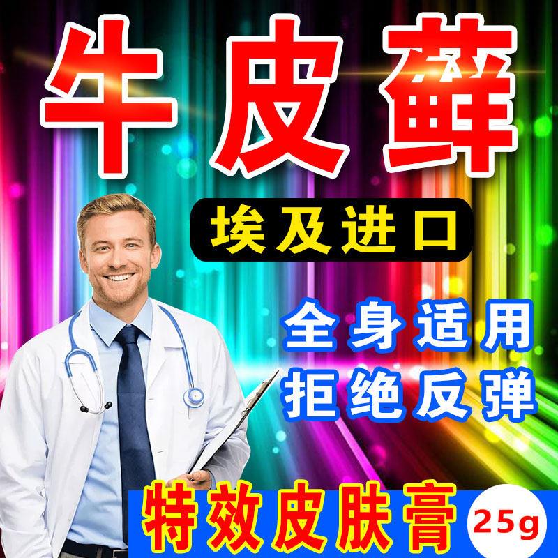 埃及进口牛皮癣皮肤瘙痒止痒手足癣大腿内侧股癣头癣银屑病专用膏