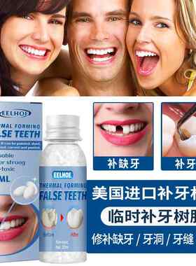 进口树脂缺牙齿洞自己填充材料牙间距宽大假牙掉牙临时修补神器
