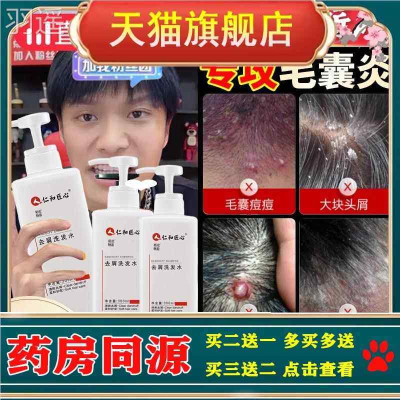 头痒有疙瘩毛囊炎中药洗发水头皮毛囊炎专用头部头上长痘痘痒有疙