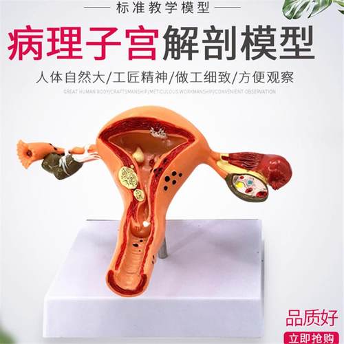 女性大子宫模型放大模型 女性生殖解剖模型 计划生育示教模型