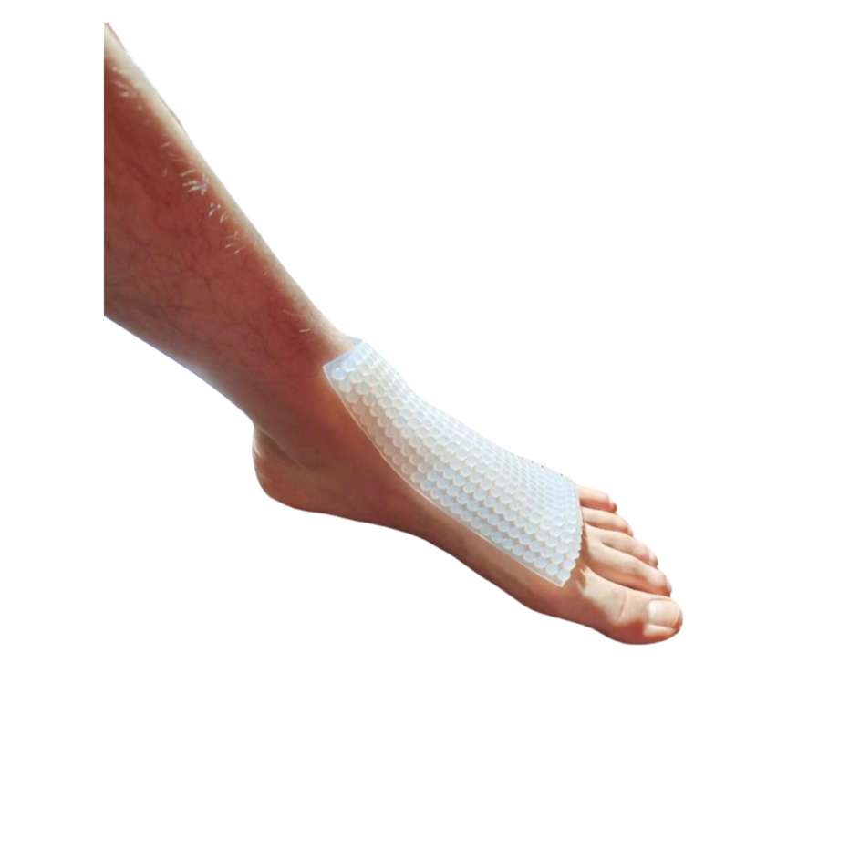 圆柱疤痕加压垫术后疙瘩防增生疤痕贴硅凝胶弹力套儿童烧烫伤医用