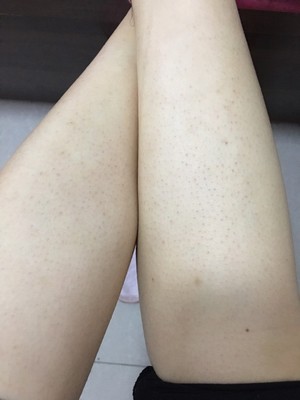 评测!不吹不黑蒂丝脱毛仪怎么样?买前担心,买后惊艳述说!