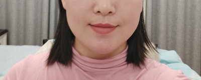 Tripollar射频美容仪提拉紧致微怎么样？我必须如此告诉大家实情