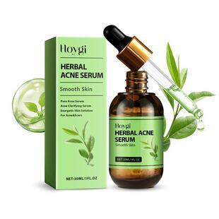 Essence and Hoygi Acne balances oil hydrates Herbal deeply