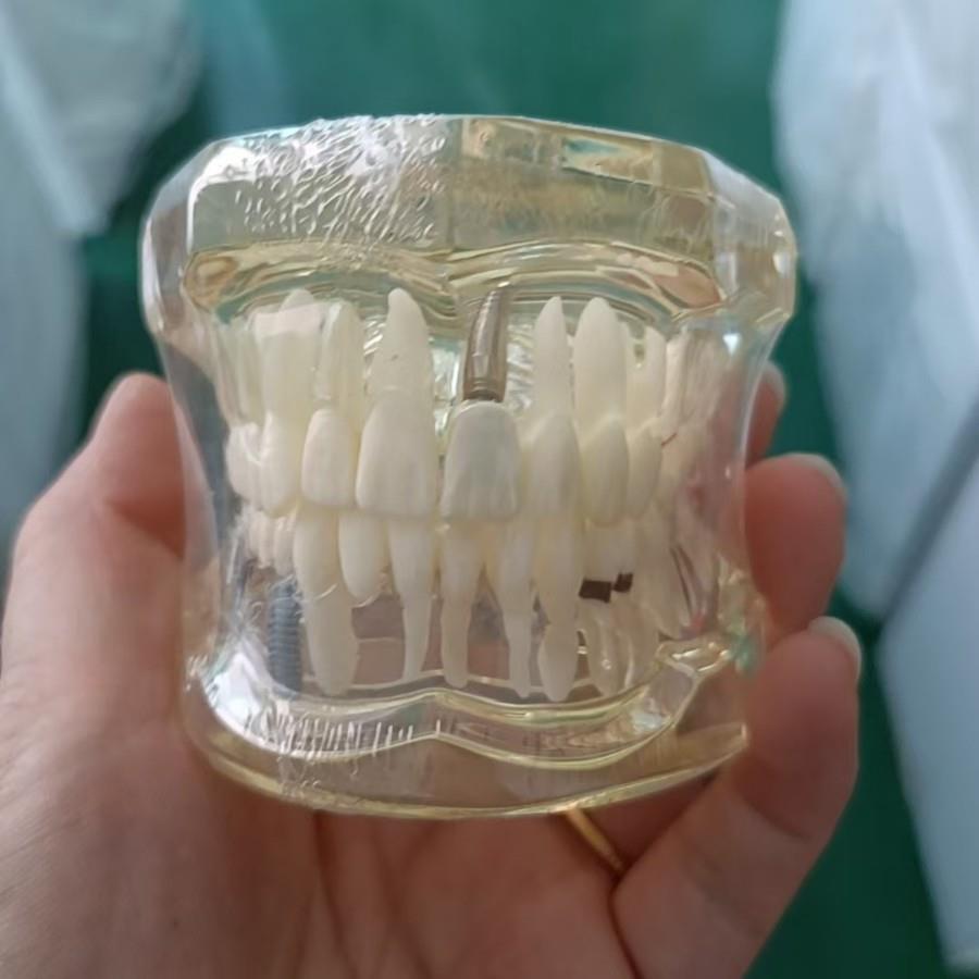 透明标准模型 28颗牙,不带托槽 牙齿模型