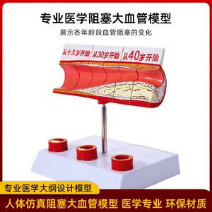 理状动ZH-28675脉性心血管脉冠模型硬化模型 人动体病模型血栓模