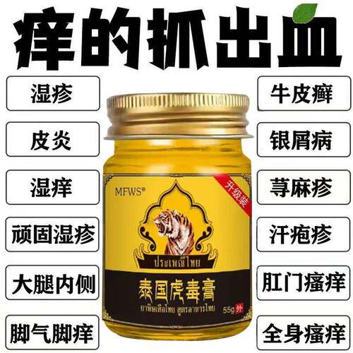 虎毒膏皮肤瘙痒全身皮肤痒手脚真菌瘙痒湿痒干痒通用抑菌止痒膏