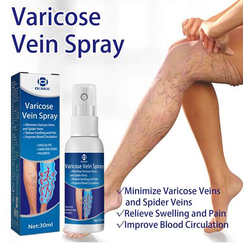OUHOE Leg Care Spray  Soothes leg skin discomfort, provides