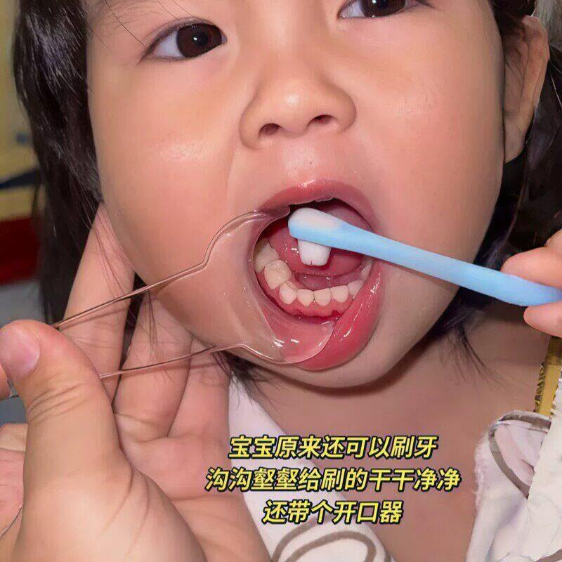 宝宝刷牙开口神器防蛀牙扩口器清洁辅助器青少年牙齿正畸刷牙神器图片