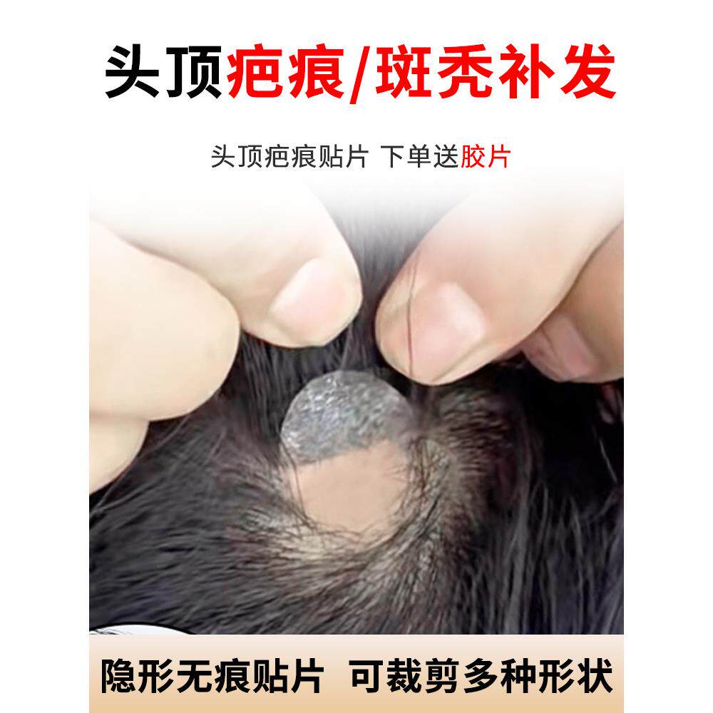 疤痕补发贴片头顶斑秃烧伤疤痕小面积假发贴片男女生物头皮全真发