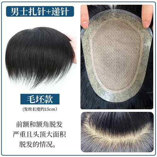 高档士假发针夏季轻薄前额真补发片发无痕生物头皮男帅气高档补发