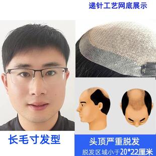高档假发男短发男士额头顶发刘海织真发织补发片块脱发前手自然补