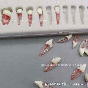 全口28颗离体牙模型 带牙根 红根管牙 破冠开髓扩大疏通根充练习