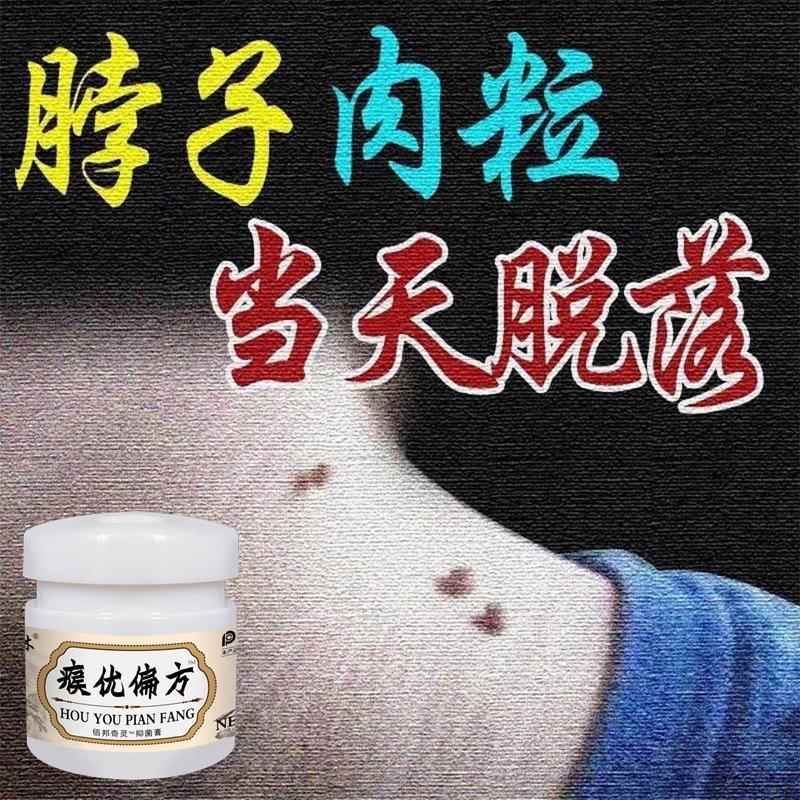 王泰林瘊优偏方?皮肤疣瘊子膏一抹灵脖子上长小肉粒面颈部专用膏1